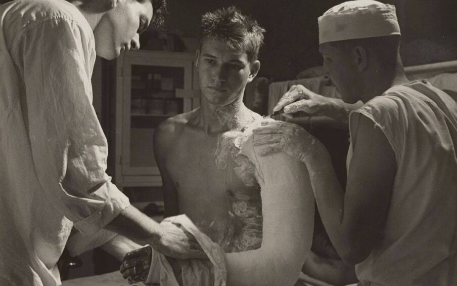 A black-and-white photograph of three light-skinned, young men. The central figure sits on a doctor’s examination table, turned three quarters to the left while having plaster applied to his left arm. He stares off to the left, his hair spikey and messy, his facial expression somber. He is shirtless and having his arm, crooked at the elbow, set from shoulder to fingers in a plaster cast. Excess plaster is slathered and splattered on his neck, chest, and stomach. He wears a band on the ring finger of this left hand. At left, another young man is seen from the side, his head bent slightly forward, light from above cast on his face. He is using a cloth on the patient’s arm. He has dark short hair, wears a loose-fitting shirt with the sleeves rolled up. At right, another young man is cutting away the rough edge of the plaster on the patient’s shoulder. This man sits on the table with the patient, his back to us, the sleeves cut off his shirt, a small white cap on his head. The background shows a supply cabinet and bunks. Light streams down from the top right corner of the photo.